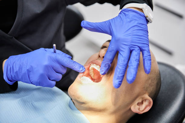 Best Chipped Tooth Repair Near Me  in Hubbard, OH